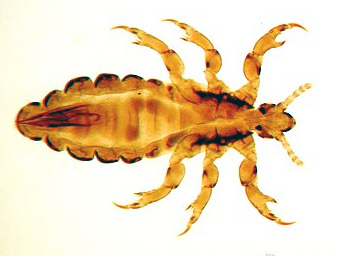 pediculus.jpg